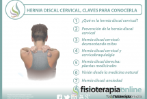 Hernia discal cervical, 23 interesantes vídeos sobre el tema