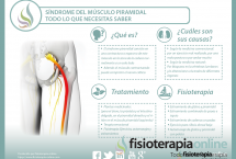 Síndrome del músculo piramidal. Qué es, causas, síntomas y tratamiento