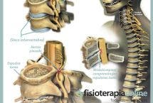 Explicando la artrosis