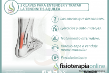 5 claves para entender y tratar la tendinitis aquilea