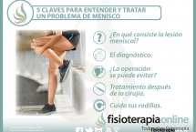  5 claves para entender y tratar un problema de menisco