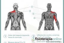 Relación entre el sistema cardio-circulatorio y el dolor de espalda