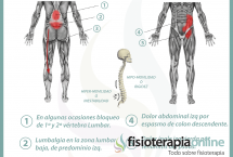 Relación entre el colon irritable y el dolor de espalda