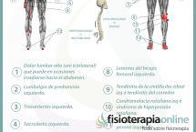 Relación entre el riñón y dolor de espalda