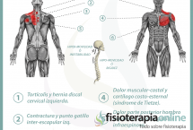 Relación entre el estómago y el dolor de espalda