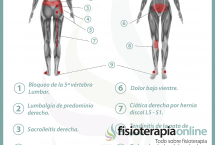 Relación entre el útero y el dolor de espalda