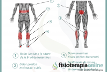 Relación entre vejiga y dolor de piernas y espalda