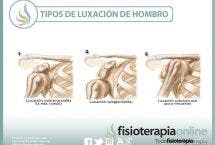 Luxación de hombro. Qué es y cuales son sus tipos