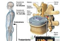 El avance de la videoendoscopia 