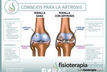 Consejos para tratar la artrosis