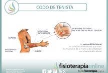 Epicondilitis, epicondilalgia, el martirizante codo de tenista