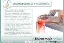 Todo lo que necesitas saber de la artrosis de rodilla o gonartrosis