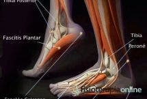 Lesiones y disfunciones del pie, conoce a los principales causantes