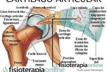 La artritis y la artrosis se refieren a la inflamación y degeneración de la articulación y el cartílago articular pero ¿qué es este cartílago?