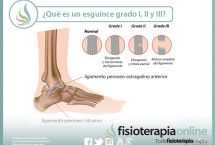 ¿Sabes qué es un esguince de tobillo y cuales son sus grados, según la importancia de la lesión?