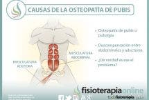 Causas de la osteopatía de pubis o pubalgia, una nueva visión