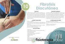 Fibrolisis Diacutanea o Técnica de ganchos. Te ayuda más de lo que te asusta