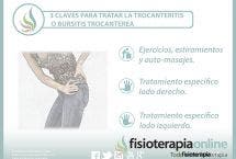 3 claves para tratar la trocanteritis o bursitis trocantérea