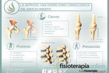 La artrosis, una visión como consecuencia del envejecimiento