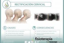 La rectificación cervical, una disfunción en auge, descubre qué es y a que se debe