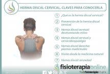 Hernia discal cervical, 23 interesantes vídeos sobre el tema