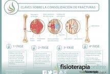 ¿Sabes cómo se consolidan o recuperan las fracturas de huesos? Descubre cómo ocurre