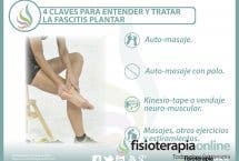 4 claves para entender y tratar la fascitis plantar