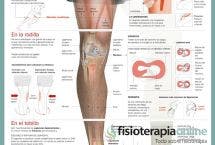 Las lesiones del futbolista, aprende cuáles son y cómo tratarlas