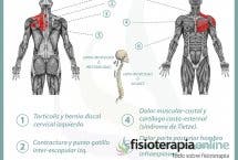 Relación entre el estómago y el dolor de espalda