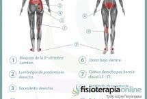 Relación entre el útero y el dolor de espalda