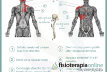 Relación entre el hígado y el dolor de espalda