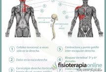 Relación entre el hígado y el dolor de espalda