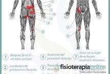 Relación entre próstata y dolor de espalda