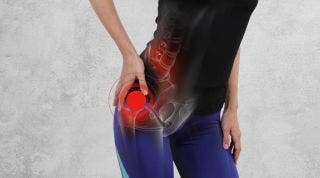 Tratamiento y ejercicios para la artrosis de cadera Tratamiento y ejercicios para la artrosis de cadera
