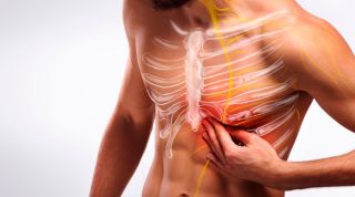 Dolor en el esternón y las costillas: ¿puede ser el síndrome de Tietze?
