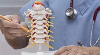 Cirugía de Hernia Discal Cervical, Cómo se realiza la operación y cómo es su rehabilitación