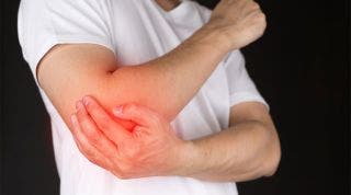 Epicondilitis lateral: por qué tu dolor de codo no se resuelve con fisioterapia convencional, reposo ni fármacos
