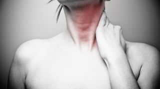 Tortícolis provocado por estrés
