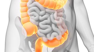¿Cómo repercute la disfunción Colon Irritable sobre el sistema Músculo-esquelético?