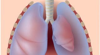 Neumotorax, clínica y clasificación