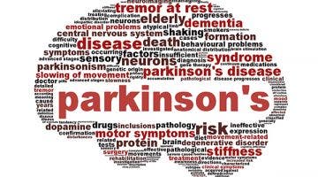 Tratamiento quirúrgico y médico del Parkinson.