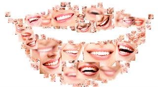 Sonrisas y analgesia Sonrisas y analgesia