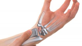 Fractura de escafoides. Causas, síntomas y tratamiento de fisioterapia