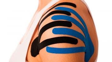 Kinesio Taping. ¿Cuál es su verdadero mecanismo de acción?