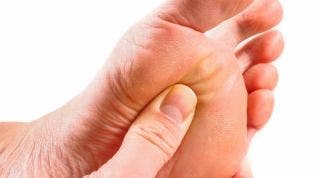 Neuroma de morton, todo lo que necesitas saber Neuroma de morton, todo lo que necesitas saber