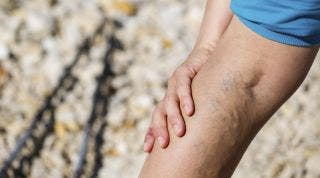 Consejos y ejercicios para mejorar la circulación de piernas