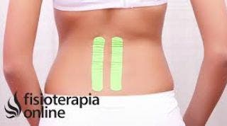 Vendaje neuromuscular para el alivio del dolor menstrual moderado Vendaje neuromuscular para el alivio del dolor menstrual moderado