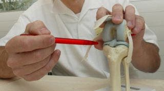Relación entre la alimentación y el desgaste del cartílago: claves para proteger tus rodillas
