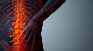 Estenosis foraminal ¿Cómo se puede movilizar la columna cuando hay dolor lumbar?