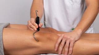 Qué es la fibrólisis diacutánea, para que sirve y como funciona